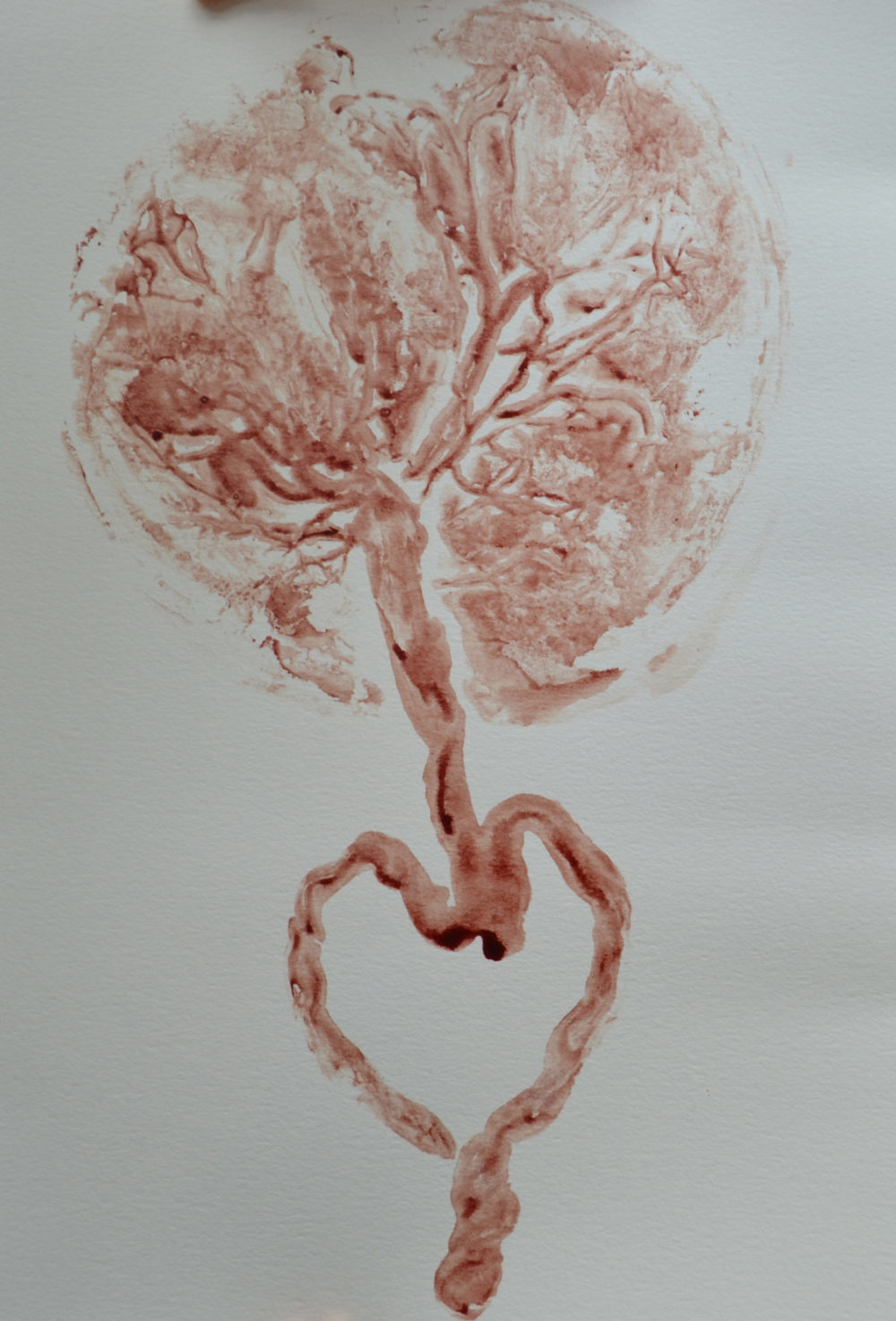 placenta twin print from Fredericksburg va. mom